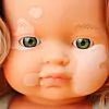 Muñeca Vitíligo 38cm MF&M